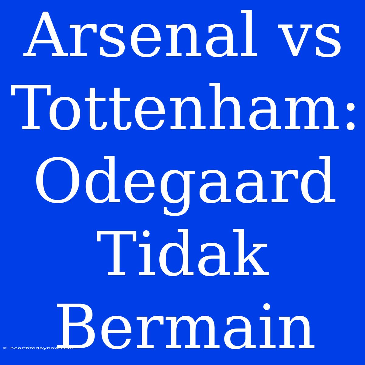 Arsenal Vs Tottenham: Odegaard Tidak Bermain